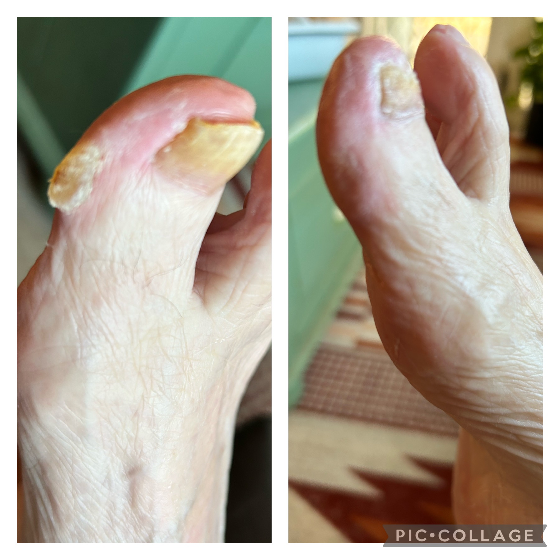 ./feet-big-toes-closeup_1780327627295